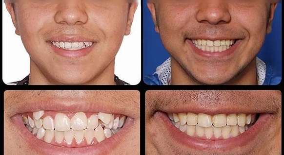 ارتودنسی متحرک در کرج