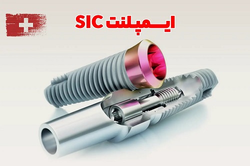 ایمپلنت SIC؛ چرا متخصصان باتجربه این برند سوئیسی را پیشنهاد میکنند؟