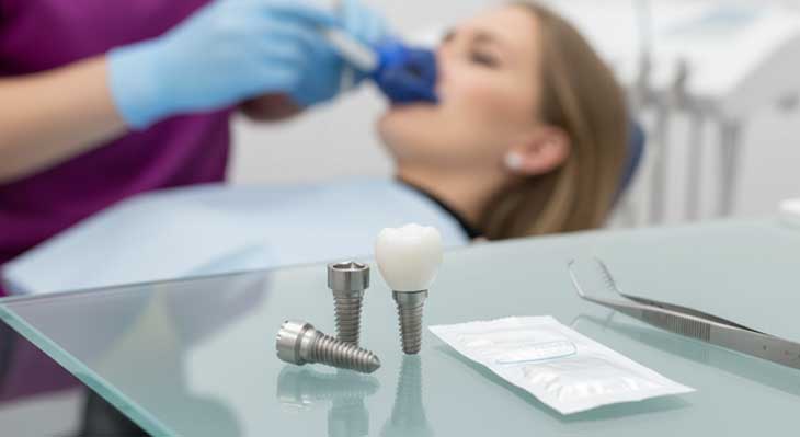 چرا برخی بیماران سالها درمان ایمپلنت را به تعویق میاندازند؟