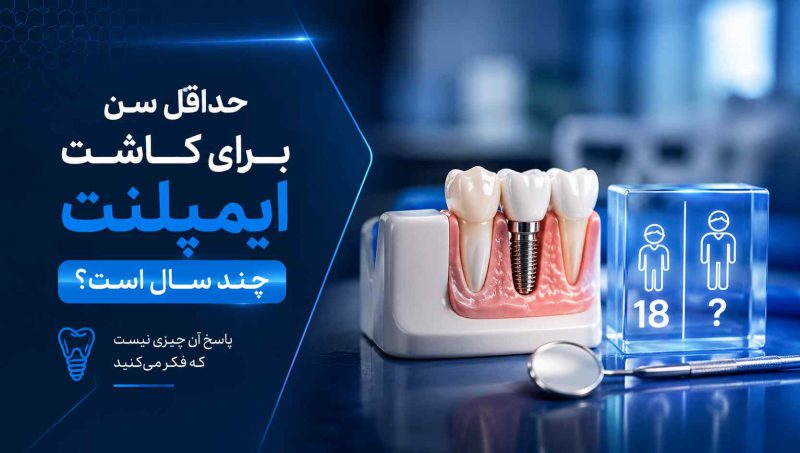 حداقل سن برای کاشت ایمپلنت چند سال است؟ پاسخ آن چیزی نیست که فکر میکنید