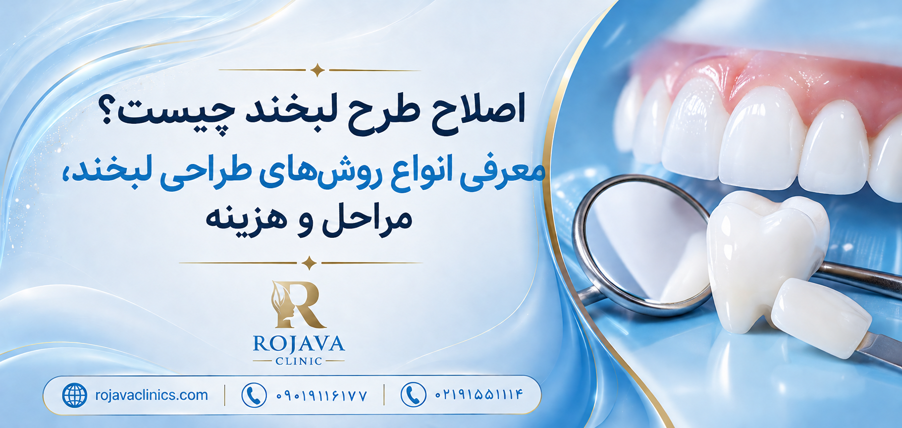 اصلاح طرح لبخند؛ صفر تا صد روشها، هزینه و مراقبتهای بعد از درمان