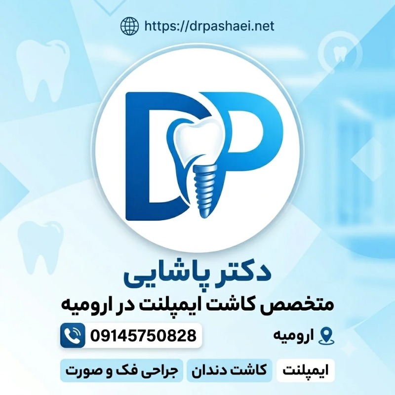 ایمپلنت دندان در ارومیه؛ راهنمای انتخاب و مراحل کاشت دندان
