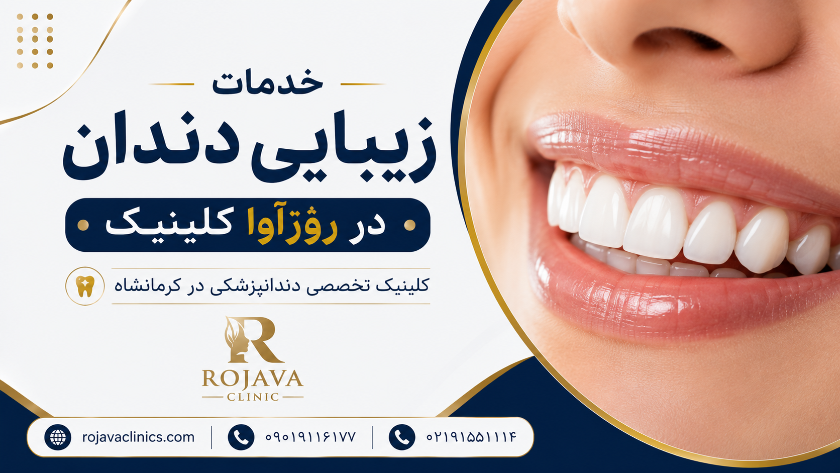 خدمات طرح لبخند در rojavaclinics.com کلینیک تخصصی دندانپزشکی در کرمانشاه