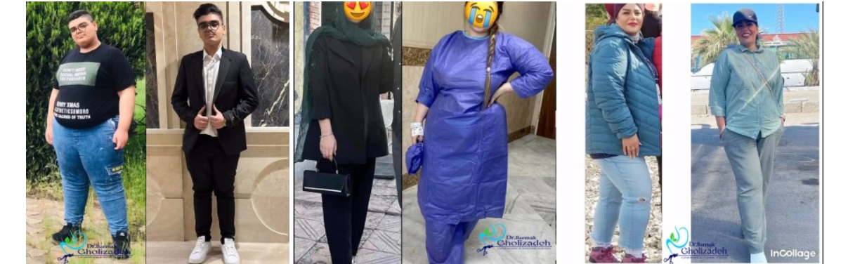 تجربه جراحی چاقی با دکتر قلی زاده؛ از انتخاب جراح تا تغییر سبک زندگی