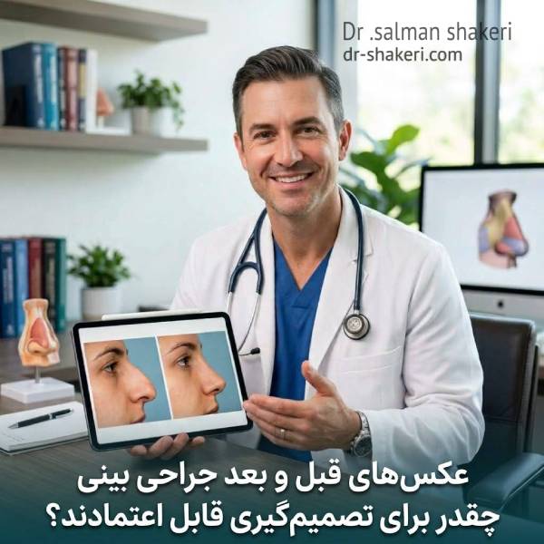 عکسهای قبل و بعد جراحی بینی چقدر برای تصمیمگیری قابل اعتمادند؟